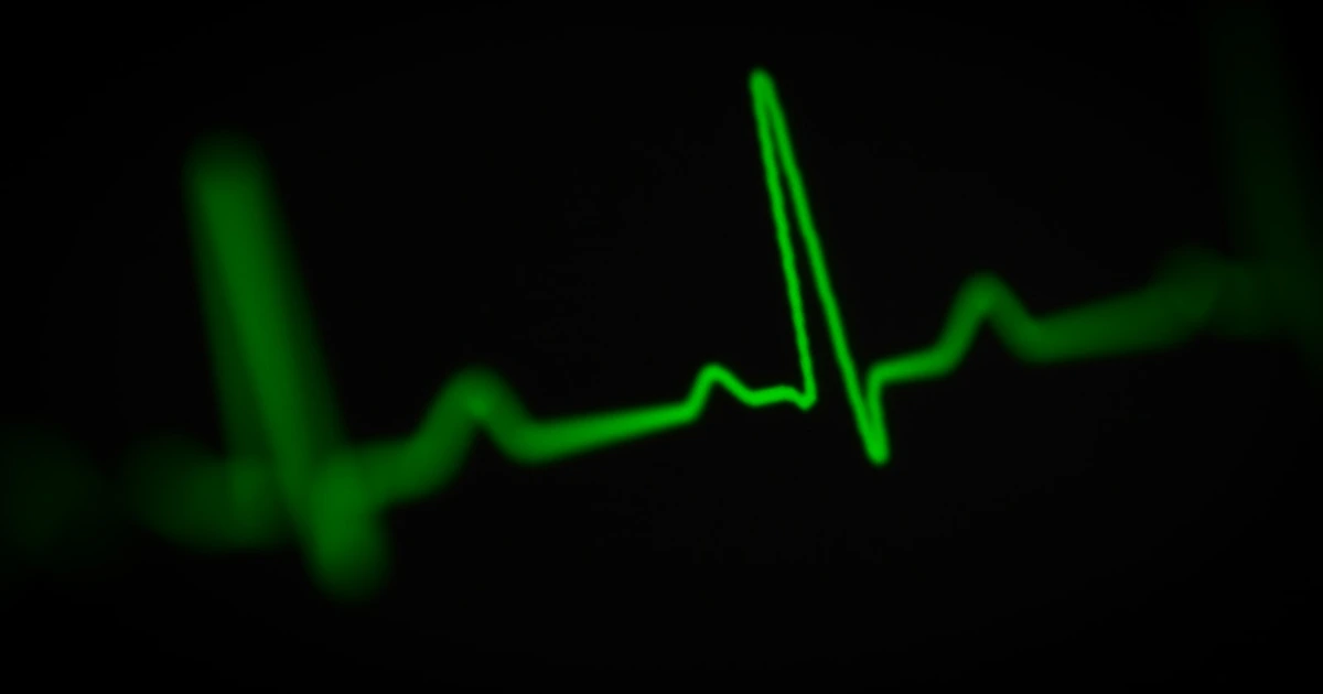 A glowing green ECG-style pulse trace on a black background